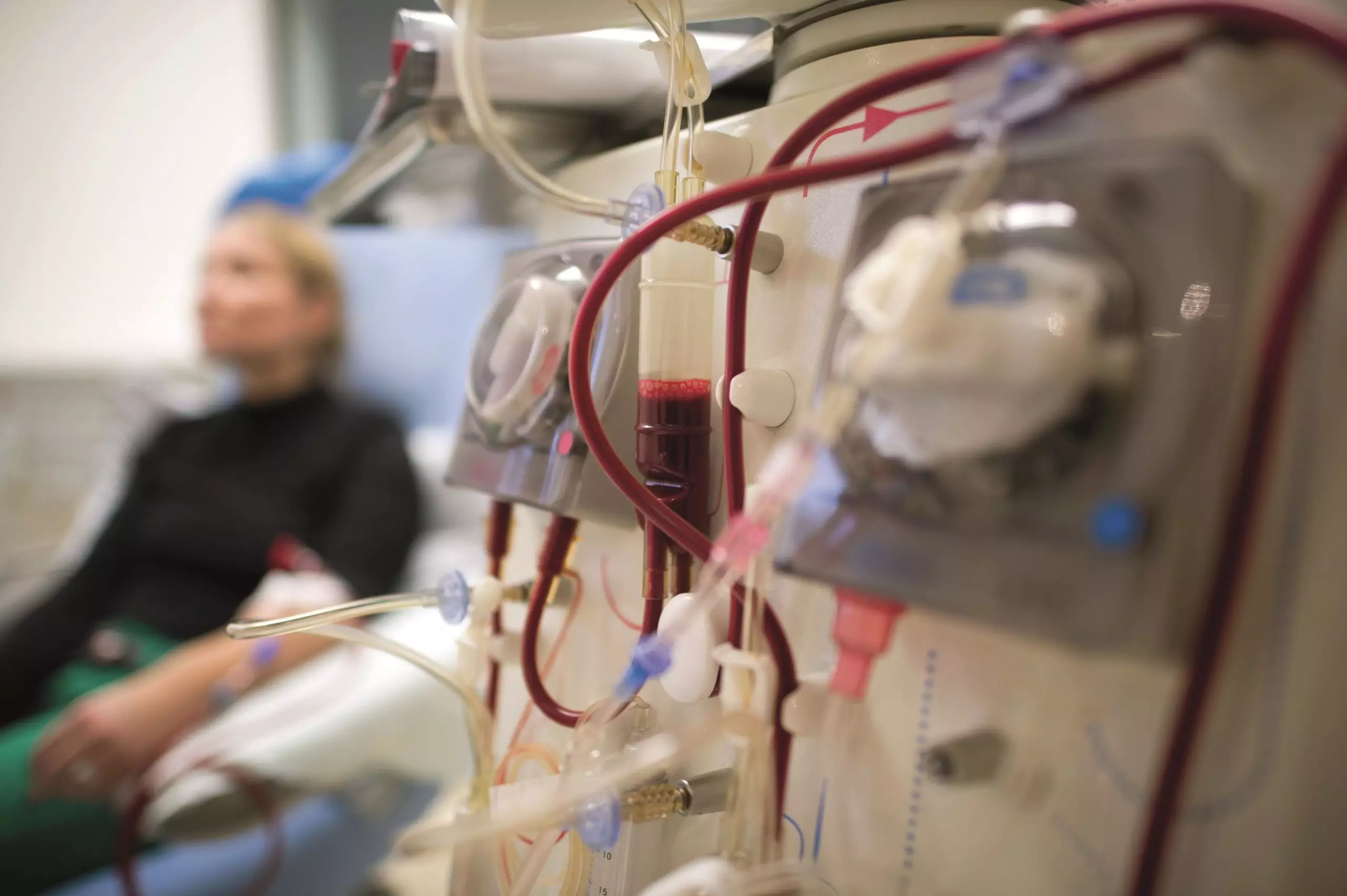 Home dialysis machine setup during treatment session