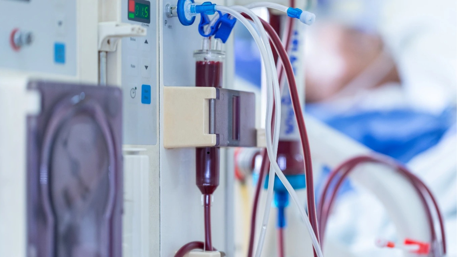 Close-up of dialysis machine tubing during home hemodialysis