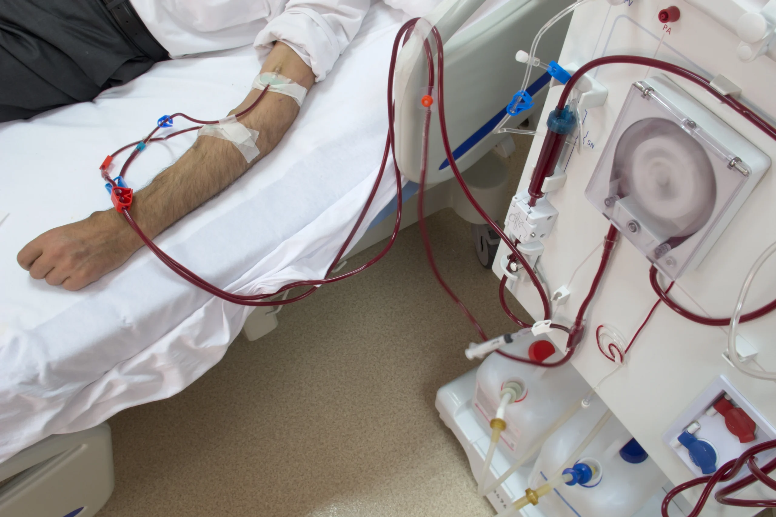 Home Dialysis Service in Lahore